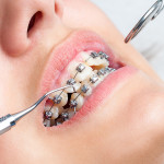 orthodontic1